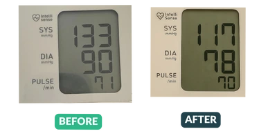 Blood pressure before and after results