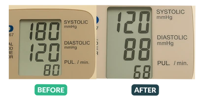 Blood pressure before and after results