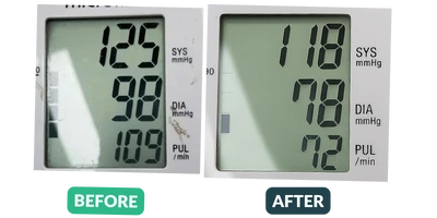 Blood pressure before and after results