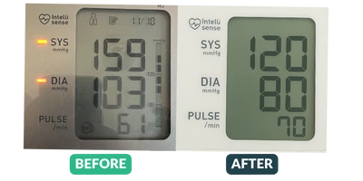 Blood pressure before and after results