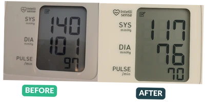 Blood pressure before and after results