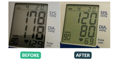 Blood pressure before and after results